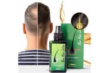 Benefits of Using Neo Hair Lotion.png