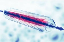 Venous Stents Market.jpg