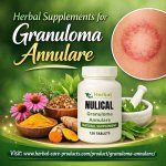 Herbal-Supplements-for-Granuloma-Annulare-1.jpg