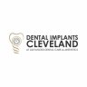 Dental Implants Cleveland
