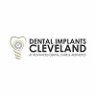 dentalimplantscleveland